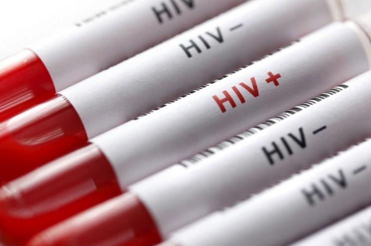 راه های پیشگیری و انتقال HIV