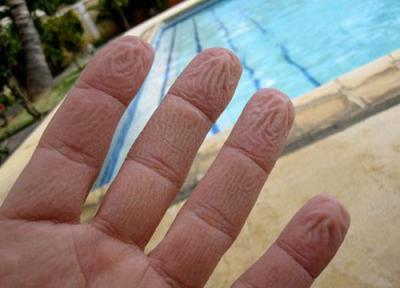 چرا پوست انگشتان دست و پا در آب چروک می گردد؟